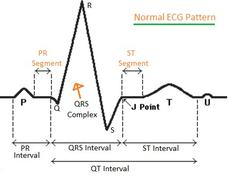 ECG, EEG, EMG: Understanding the Differences