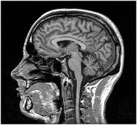 CT Scan vs. MRI Scan vs. Ultrasound Scan: A Detailed Comparison