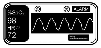 Pulse Oximeter: Advantages and Disadvantages