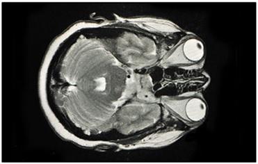 CT scan