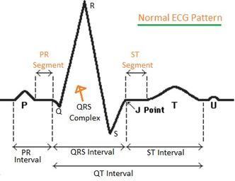 ECG, EEG, EMG: Understanding the Differences